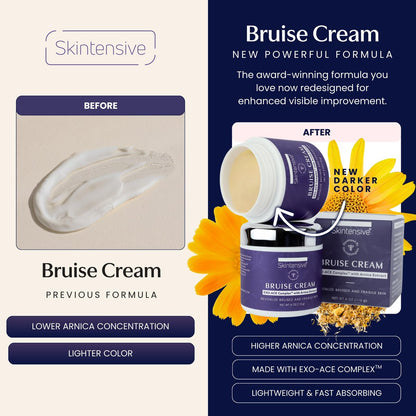 SKINTENSIVE Arnica Bruise Cream for Thin Skin - Moisturizing Arnica Cream with Vitamin K, C, and E for Skin Renewal, 4 oz