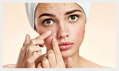 IS4A Pure Sandalwood (Chandan) Powder 1.23 oz – Natural Face Mask & Skin Care Avelisse