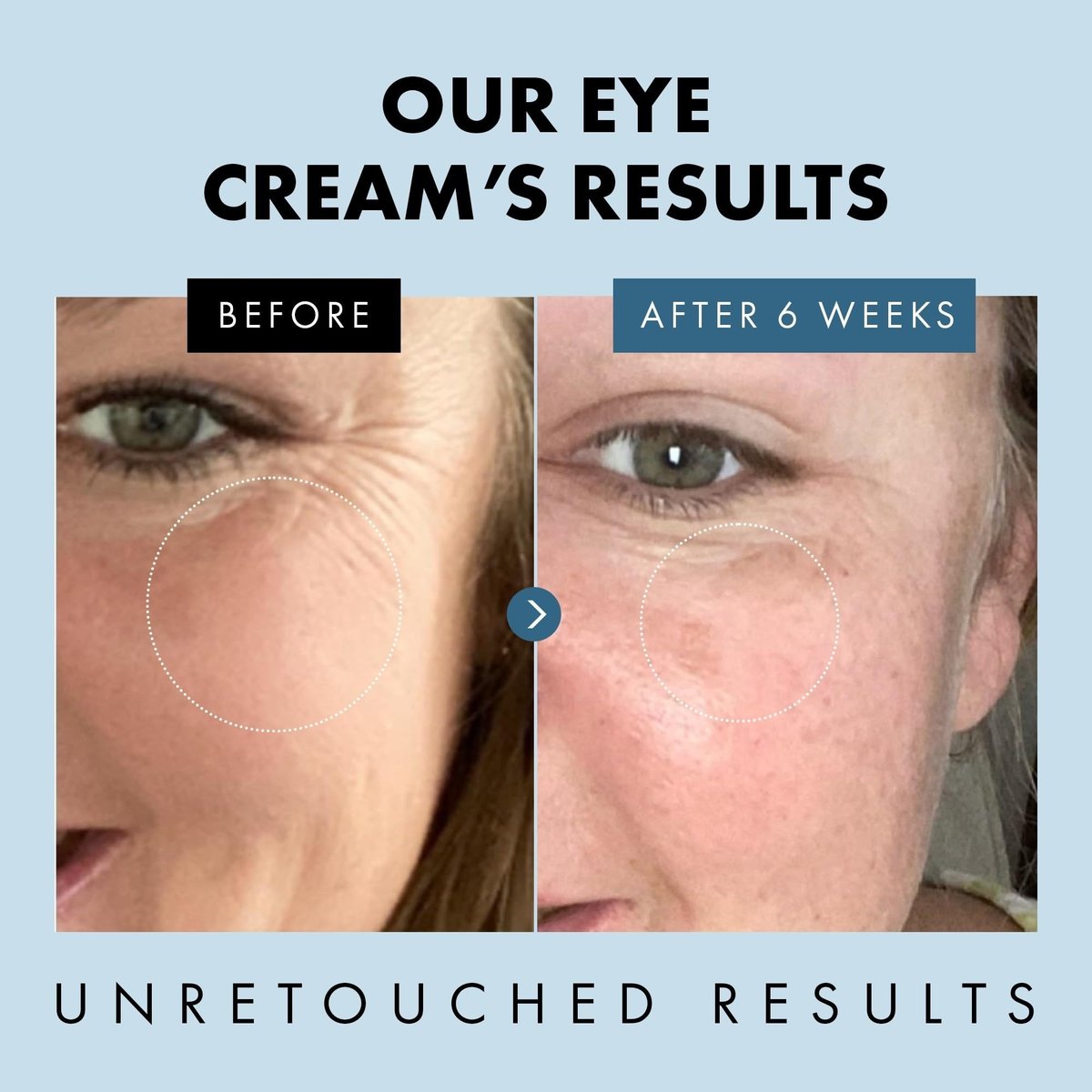 Eclat Skincare Under Eye Cream for Dark Circles & Puffiness – Anti Aging Formula for Wrinkles - Moisturizer for Fine Lines, Crows Feet & Eye Bags – Hydrating Treatment for Firming & Smoothing - 30ml - görsel 5