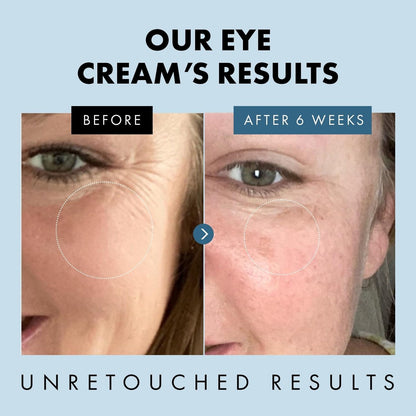 Eclat Skincare Under Eye Cream for Dark Circles & Puffiness – Anti Aging Formula for Wrinkles - Moisturizer for Fine Lines, Crows Feet & Eye Bags – Hydrating Treatment for Firming & Smoothing - 30ml