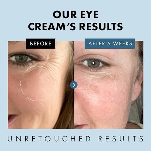 Eclat Skincare Under Eye Cream for Dark Circles & Puffiness – Anti Aging Formula for Wrinkles - Moisturizer for Fine Lines, Crows Feet & Eye Bags – Hydrating Treatment for Firming & Smoothing - 30ml - görsel 6