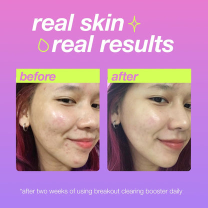 Dermalogica Clear Start Breakout Clearing Booster - Acne Spot Treatment with Salicylic Acid, 1 fl oz Avelisse
