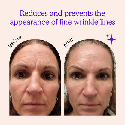 BLUMBODY Face & Forehead Wrinkle Patches – Non-Silicone Anti-Wrinkle Tape for Smoothing Eye, Mouth, Forehead Lines – 165 Count (30-Day Supply) Avelisse