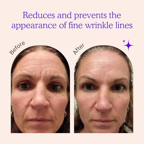 BLUMBODY Face & Forehead Wrinkle Patches – Non-Silicone Anti-Wrinkle Tape for Smoothing Eye, Mouth, Forehead Lines – 165 Count (30-Day Supply) Avelisse