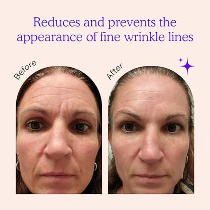 BLUMBODY Face & Forehead Wrinkle Patches – Non-Silicone Anti-Wrinkle Tape for Smoothing Eye, Mouth, Forehead Lines – 165 Count (30-Day Supply) Avelisse