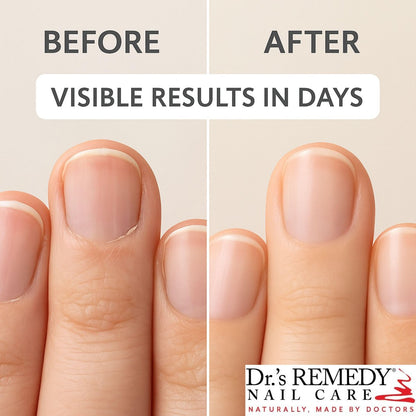 Dr.'s Remedy Therapeutic Caress Cuticle Oil – Nourishing Treatment for Healthy Nails, 0.51 Fl Oz Avelisse