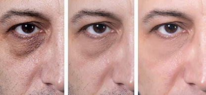Anti-Aging Eye Gel for Dark Circles, Puffiness, and Wrinkles – Hyaluronic Acid & Aloe Vera – 1.7 fl. oz. Avelisse
