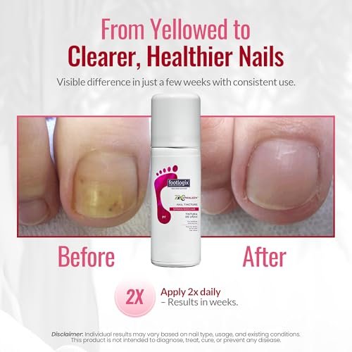 FOOTLOGIX Nail Tincture Spray with Spiraleen - 1.55 Fl Oz, Clear Nail Treatment Avelisse