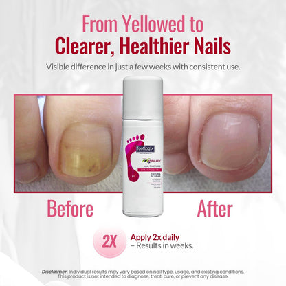 FOOTLOGIX Nail Tincture Spray with Spiraleen - 1.55 Fl Oz, Clear Nail Treatment Avelisse