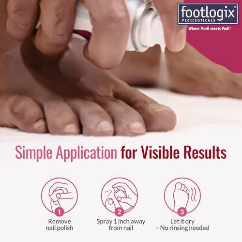 FOOTLOGIX Nail Tincture Spray with Spiraleen - 1.55 Fl Oz, Clear Nail Treatment Avelisse