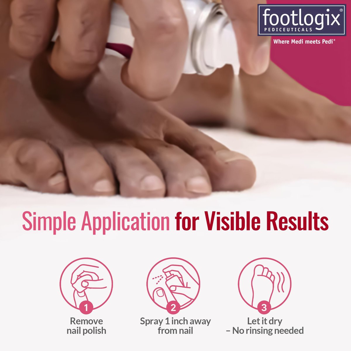FOOTLOGIX Nail Tincture Spray with Spiraleen - 1.55 Fl Oz, Clear Nail Treatment Avelisse