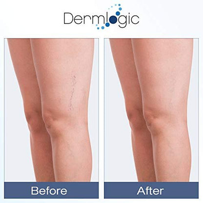 Dermlogic Vitamin K Cream – Moisturizing Bruise Healing Formula with Arnica, Dark Spot Corrector for Bruising, Spider Veins & Broken Capillaries, Reduces Under Eye Dark Circles, Fine Lines, Puffiness & Wrinkles Avelisse