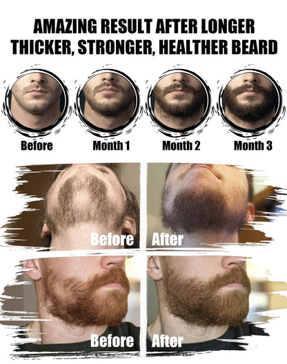 Ultimate Beard Kit for Men – 11 Piece Grooming & Care Set with Sandalwood Beard Oil, Balm, Wash, Conditioner, Brush, Comb & Scissors – Perfect Gift for Dad, Husband, Him Avelisse