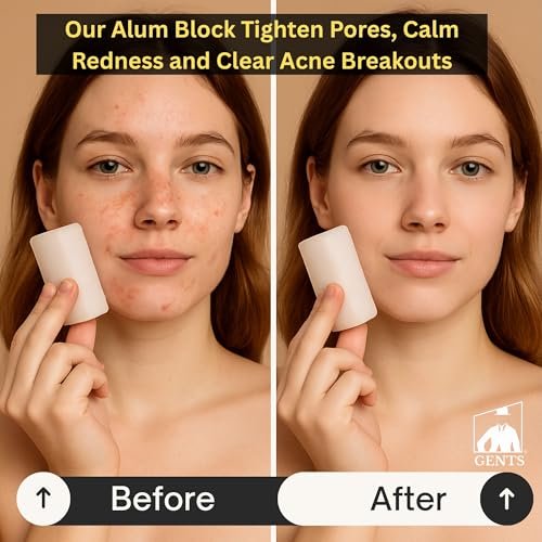 Gents Alum Block in Plastic Case – Upgrade Your Shave with Soothing Aftershave Solution for Razor Burn Relief, Travel-Friendly Durable Plastic Case, 3.5 Ounces (Pack of 3) - görsel 10