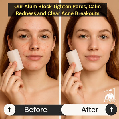 Gents Alum Block in Plastic Case – Upgrade Your Shave with Soothing Aftershave Solution for Razor Burn Relief, Travel-Friendly Durable Plastic Case, 3.5 Ounces (Pack of 3)