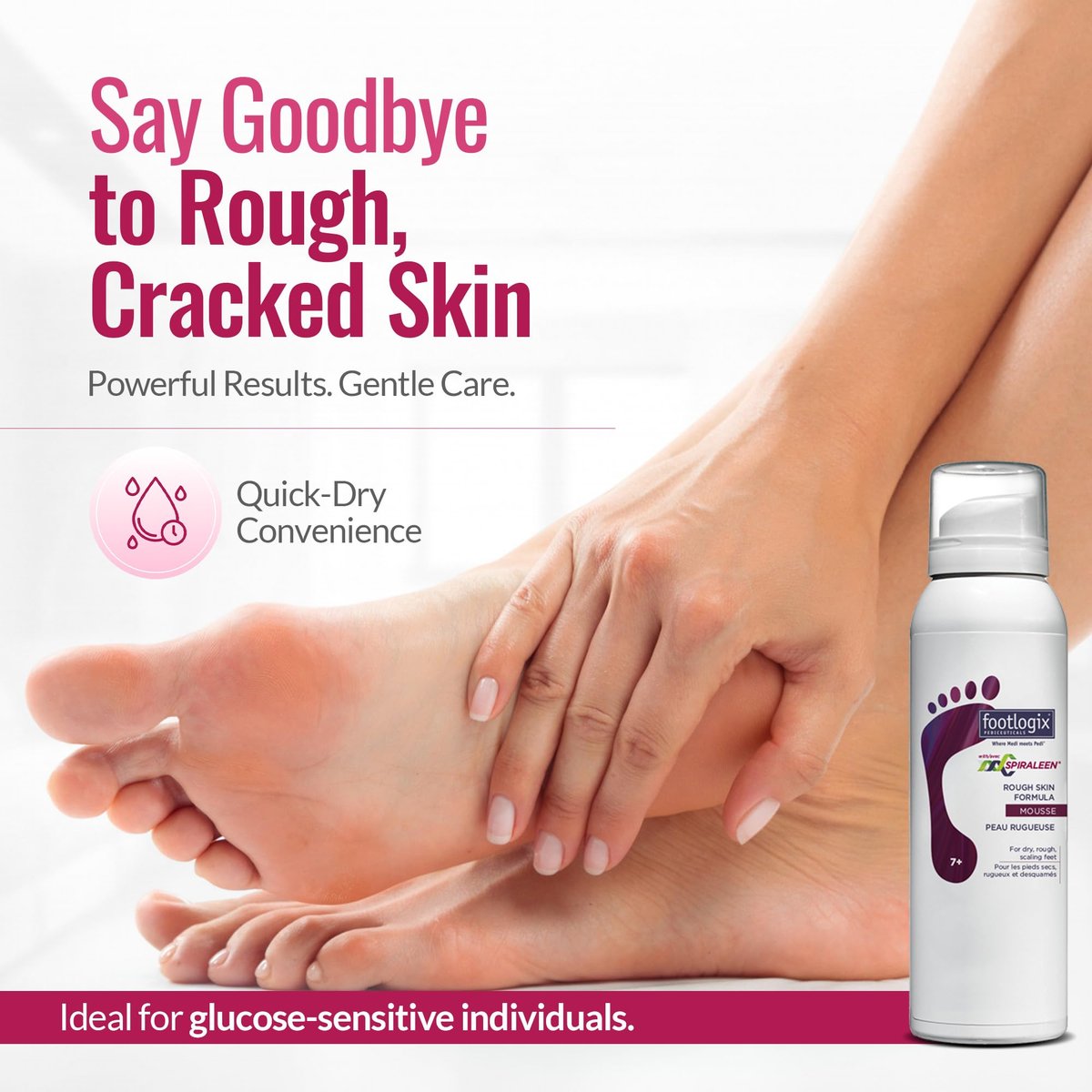 Footlogix Rough Skin Formula with Spiraleen – Mousse for Dry Cracked Heels & Feet | 4.23 oz Avelisse
