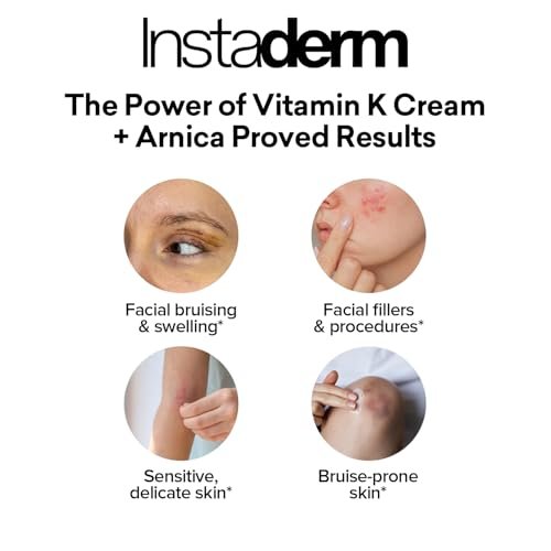 Revitalizing Vitamin K Cream with Arnica – Reduces Appearance of Bruising, Spider Veins, Broken Capillaries, Dark Circles & Puffiness – 2 Fl Oz Avelisse
