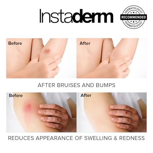 Revitalizing Vitamin K Cream with Arnica – Reduces Appearance of Bruising, Spider Veins, Broken Capillaries, Dark Circles & Puffiness – 2 Fl Oz Avelisse