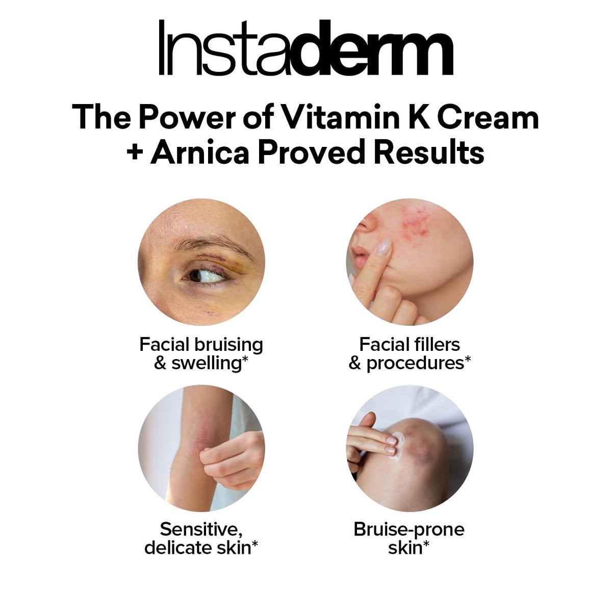 Revitalizing Vitamin K Cream with Arnica – Reduces Appearance of Bruising, Spider Veins, Broken Capillaries, Dark Circles & Puffiness – 2 Fl Oz Avelisse