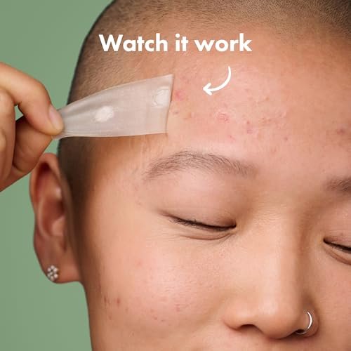 Mighty Patch Surface Large Pimple Patches for Face - Hydrocolloid Acne Spot Patch for Cheek, Forehead, Chin - Vegan-Friendly - 10 Count Avelisse
