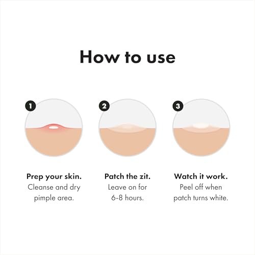Mighty Patch Surface Large Pimple Patches for Face - Hydrocolloid Acne Spot Patch for Cheek, Forehead, Chin - Vegan-Friendly - 10 Count Avelisse