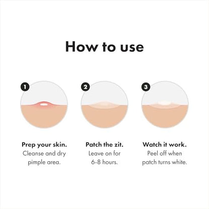 Mighty Patch Surface Large Pimple Patches for Face - Hydrocolloid Acne Spot Patch for Cheek, Forehead, Chin - Vegan-Friendly - 10 Count Avelisse