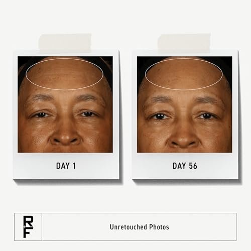 RODAN + FIELDS Redefine Daily Face Clay Cleanser (125 mL) - Exfoliating Face Wash & Mask for Sensitive Skin, Anti-Aging for Women and Men Avelisse