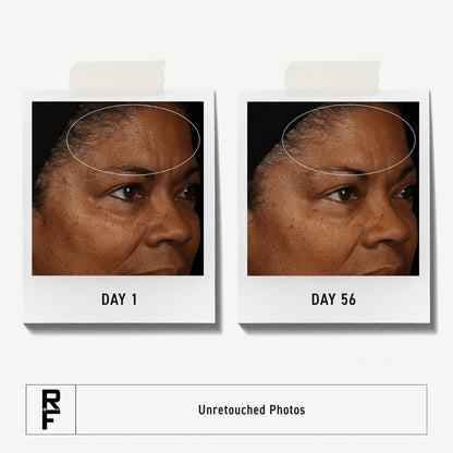 RODAN + FIELDS Redefine Daily Face Clay Cleanser (125 mL) - Exfoliating Face Wash & Mask for Sensitive Skin, Anti-Aging for Women and Men Avelisse