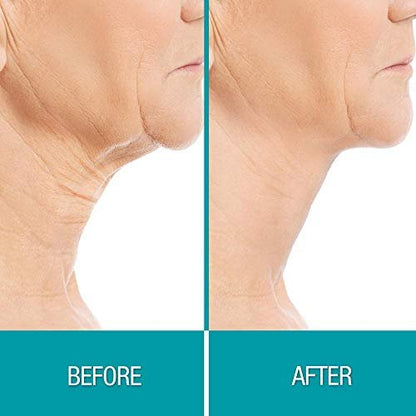 Dermactin Crepe Be Gone Firming Neck Cream – 3 oz, Anti-Aging & Hydrating Neck & Décolleté Treatment