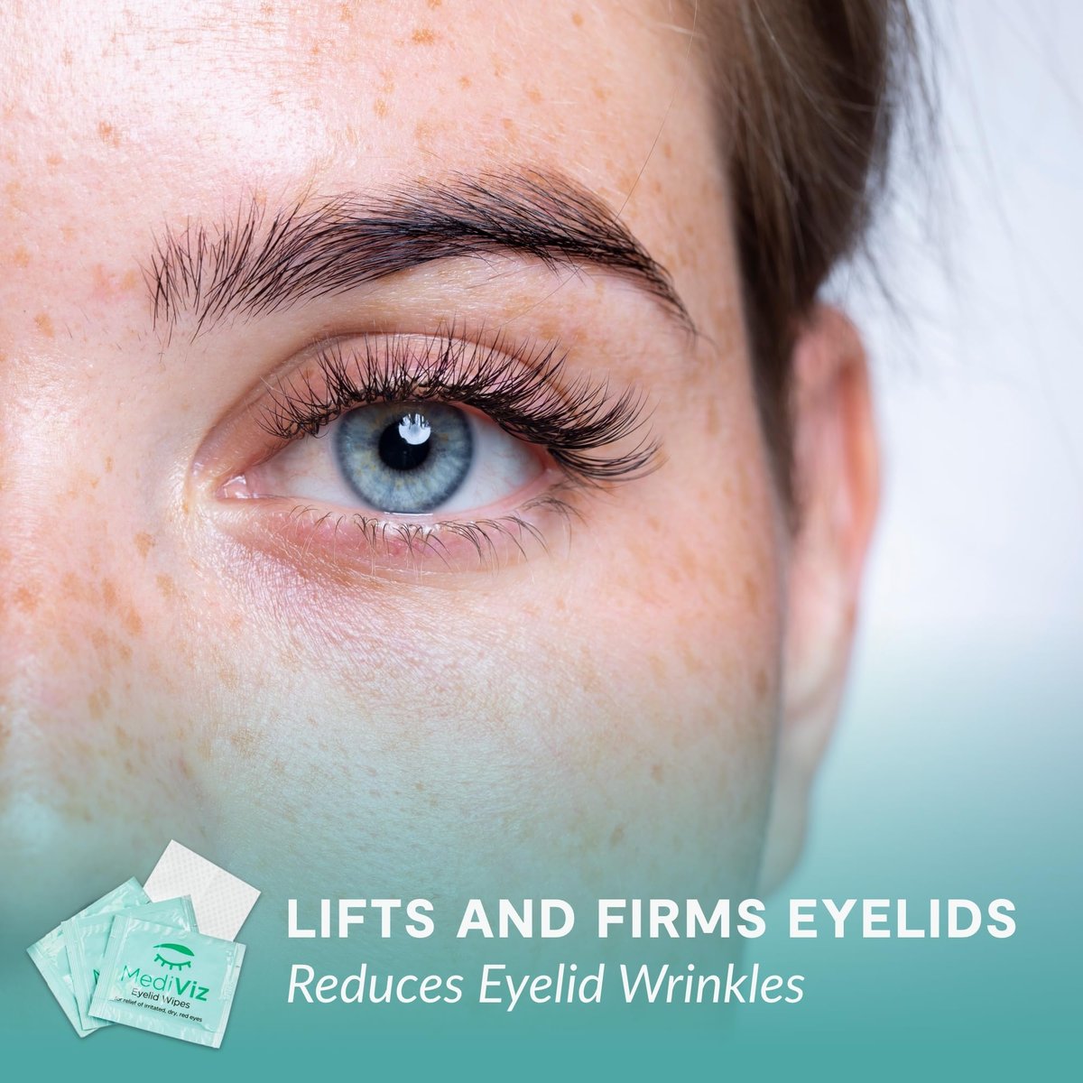 MEDIVIZ Eyelid Cleanser Wipes - 30 Single-Use Towelettes - Gentle, Hypoallergenic Eyelid Wipes for Soothing Itchy Eyes, Removing Debris & Eye Makeup Avelisse
