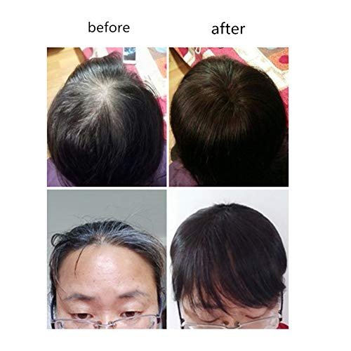 LXUE 10" Dark Brown Real Human Hair Clip in Toppers with Bangs – Hairpieces for Thinning Hair - görsel 1