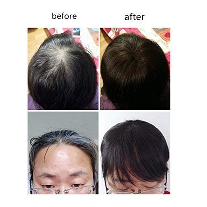 LXUE 10" Dark Brown Real Human Hair Clip in Toppers with Bangs – Hairpieces for Thinning Hair
