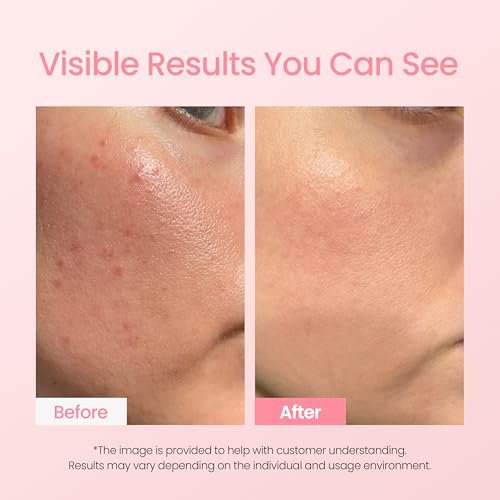 NEOGEN A-Clear Soothing Pink Eraser - Spot Care & Blemish Treatment with Calamine Powder, Korean Skin Care for Face and Skin, 0.50 Fl Oz Avelisse