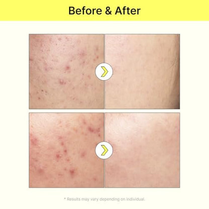 TIAM Vita B3 Source Niacinamide 10% + Arbutin 2% Tone-Balancing Serum for Uneven Skin Tone, Dark Spot Care, 1.35 fl oz Avelisse