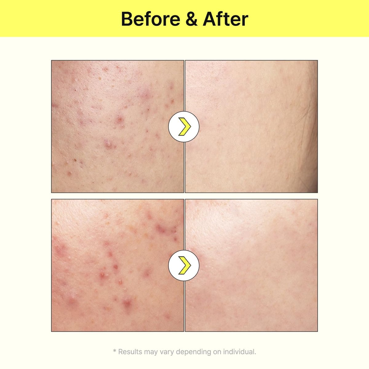 TIAM Vita B3 Source Niacinamide 10% + Arbutin 2% Tone-Balancing Serum for Uneven Skin Tone, Dark Spot Care, 1.35 fl oz Avelisse