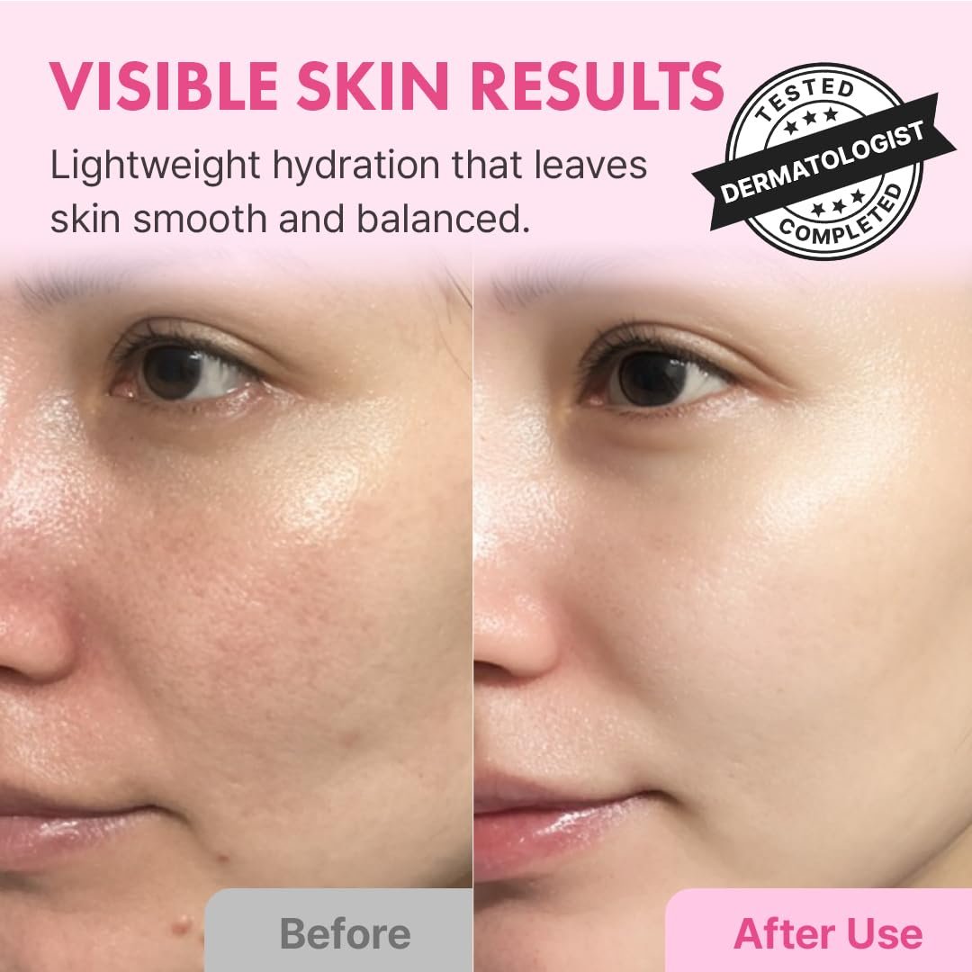 Hanskin Hyaluron Skin Essence Toner – Korean Hydrating Toner for Glass Skin | Hyaluronic Acid & Collagen | Lightweight Moisturizing Astringent for Dry, Sensitive & Dull Skin | K-Beauty (5.07 fl oz) Avelisse