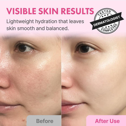 Hanskin Hyaluron Skin Essence Toner – Korean Hydrating Toner for Glass Skin | Hyaluronic Acid & Collagen | Lightweight Moisturizing Astringent for Dry, Sensitive & Dull Skin | K-Beauty (5.07 fl oz) Avelisse