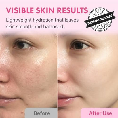 Hanskin Hyaluron Skin Essence Toner – Korean Hydrating Toner for Glass Skin | Hyaluronic Acid & Collagen | Lightweight Moisturizing Astringent for Dry, Sensitive & Dull Skin | K-Beauty (5.07 fl oz) Avelisse