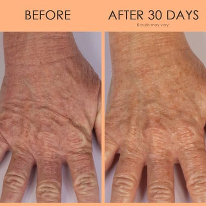 BODY FIRM Crepe Erase Hand Repair Treatment - Anti-Aging Hand Cream with Shea Butter, Vitamin E & Squalane for Dry, Cracked Hands, 3 fl oz