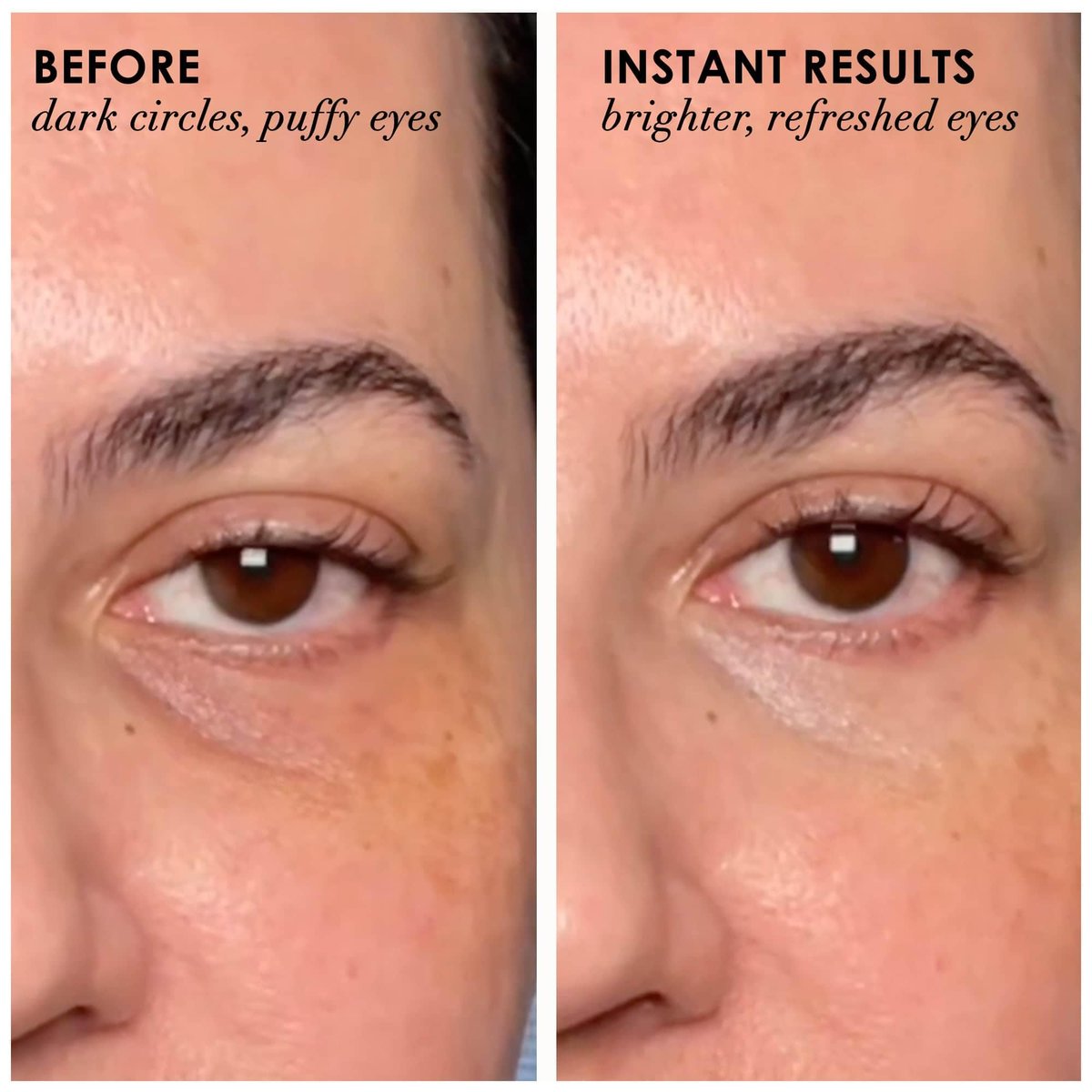 Dermelect Revitalite Eyelid & Dark Circle Corrector – Professional Strength Anti-Aging Eye Cream with Peptides, Brightening & Tightening for Dark Circles, Puffiness, Droopy Eyelids & Wrinkles Avelisse