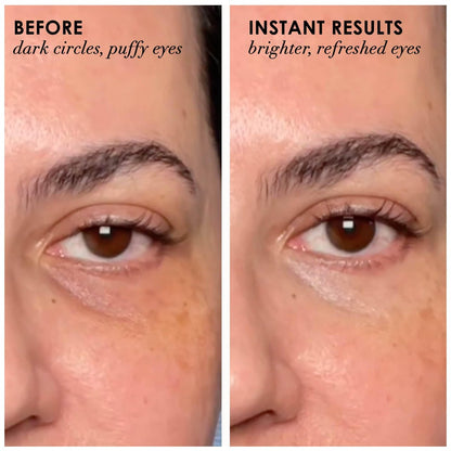 Dermelect Revitalite Eyelid & Dark Circle Corrector – Professional Strength Anti-Aging Eye Cream with Peptides, Brightening & Tightening for Dark Circles, Puffiness, Droopy Eyelids & Wrinkles Avelisse