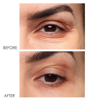 Dermelect Revitalite Eyelid & Dark Circle Corrector – Professional Strength Anti-Aging Eye Cream with Peptides, Brightening & Tightening for Dark Circles, Puffiness, Droopy Eyelids & Wrinkles Avelisse