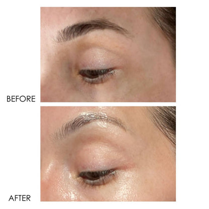 Dermelect Revitalite Eyelid & Dark Circle Corrector – Professional Strength Anti-Aging Eye Cream with Peptides, Brightening & Tightening for Dark Circles, Puffiness, Droopy Eyelids & Wrinkles Avelisse