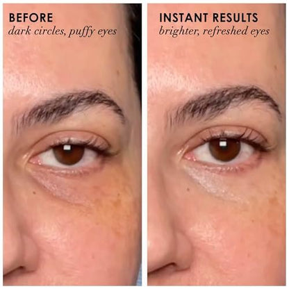 Dermelect Revitalite Eyelid & Dark Circle Corrector – Professional Strength Anti-Aging Eye Cream with Peptides, Brightening & Tightening for Dark Circles, Puffiness, Droopy Eyelids & Wrinkles Avelisse