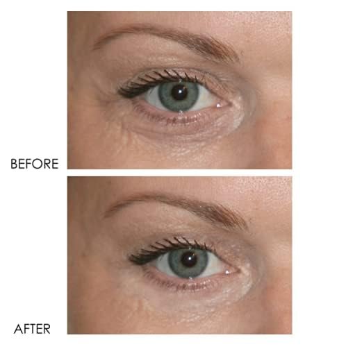 Dermelect Revitalite Eyelid & Dark Circle Corrector – Professional Strength Anti-Aging Eye Cream with Peptides, Brightening & Tightening for Dark Circles, Puffiness, Droopy Eyelids & Wrinkles Avelisse
