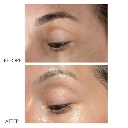 Dermelect Revitalite Eyelid & Dark Circle Corrector – Professional Strength Anti-Aging Eye Cream with Peptides, Brightening & Tightening for Dark Circles, Puffiness, Droopy Eyelids & Wrinkles Avelisse