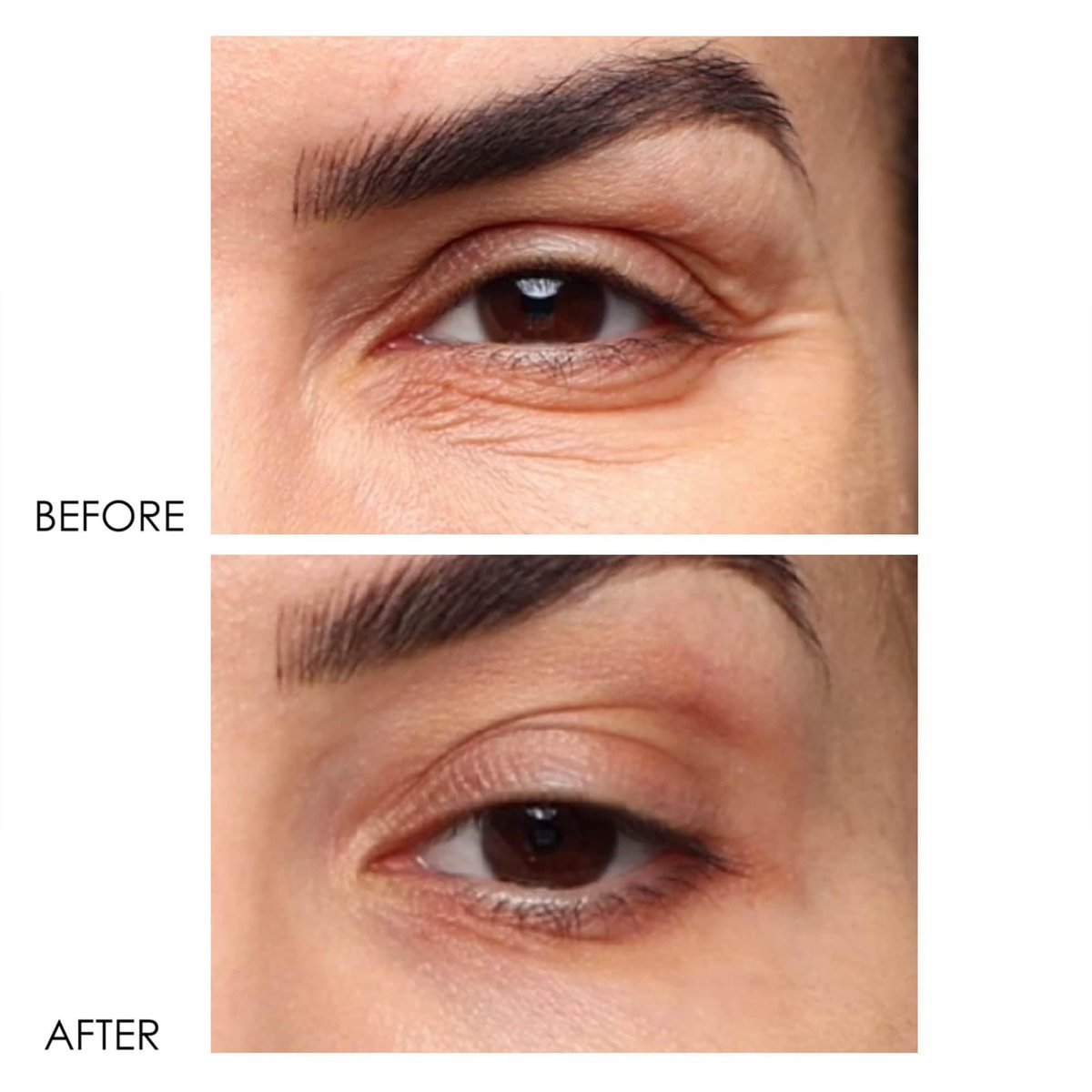 Dermelect Revitalite Eyelid & Dark Circle Corrector – Professional Strength Anti-Aging Eye Cream with Peptides, Brightening & Tightening for Dark Circles, Puffiness, Droopy Eyelids & Wrinkles Avelisse