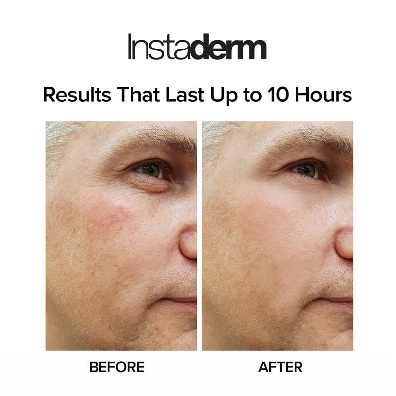 Instant Eye Tightener – Reduce Under Eye Bags, Puffiness, Dark Circles & Wrinkles | Naturally Ageless Hydrating Cream by Instaderm Avelisse