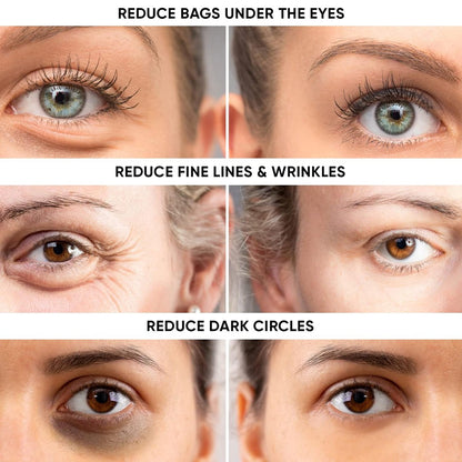 Instant Eye Tightener – Reduce Under Eye Bags, Puffiness, Dark Circles & Wrinkles | Naturally Ageless Hydrating Cream by Instaderm Avelisse