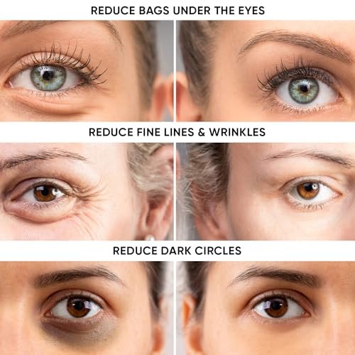 Instant Eye Tightener – Reduce Under Eye Bags, Puffiness, Dark Circles & Wrinkles | Naturally Ageless Hydrating Cream by Instaderm Avelisse